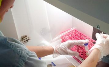 Coopeavi disponibiliza ferramenta para diagnosticar causa da mastite em até 24 horas