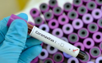Coronavírus está levando economia global para a recessão