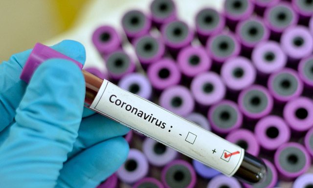 Cadeia alimentar nos Estados Unidos sofre mudanças com a epidemia